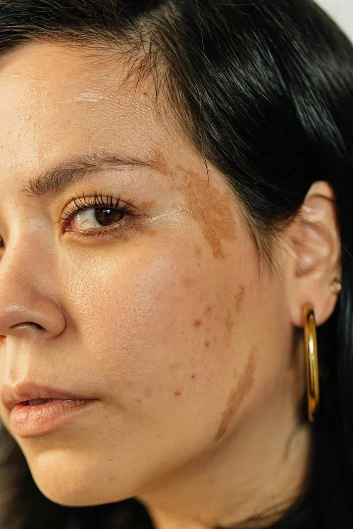 huile ozonée soin naturel peau sensible pozone