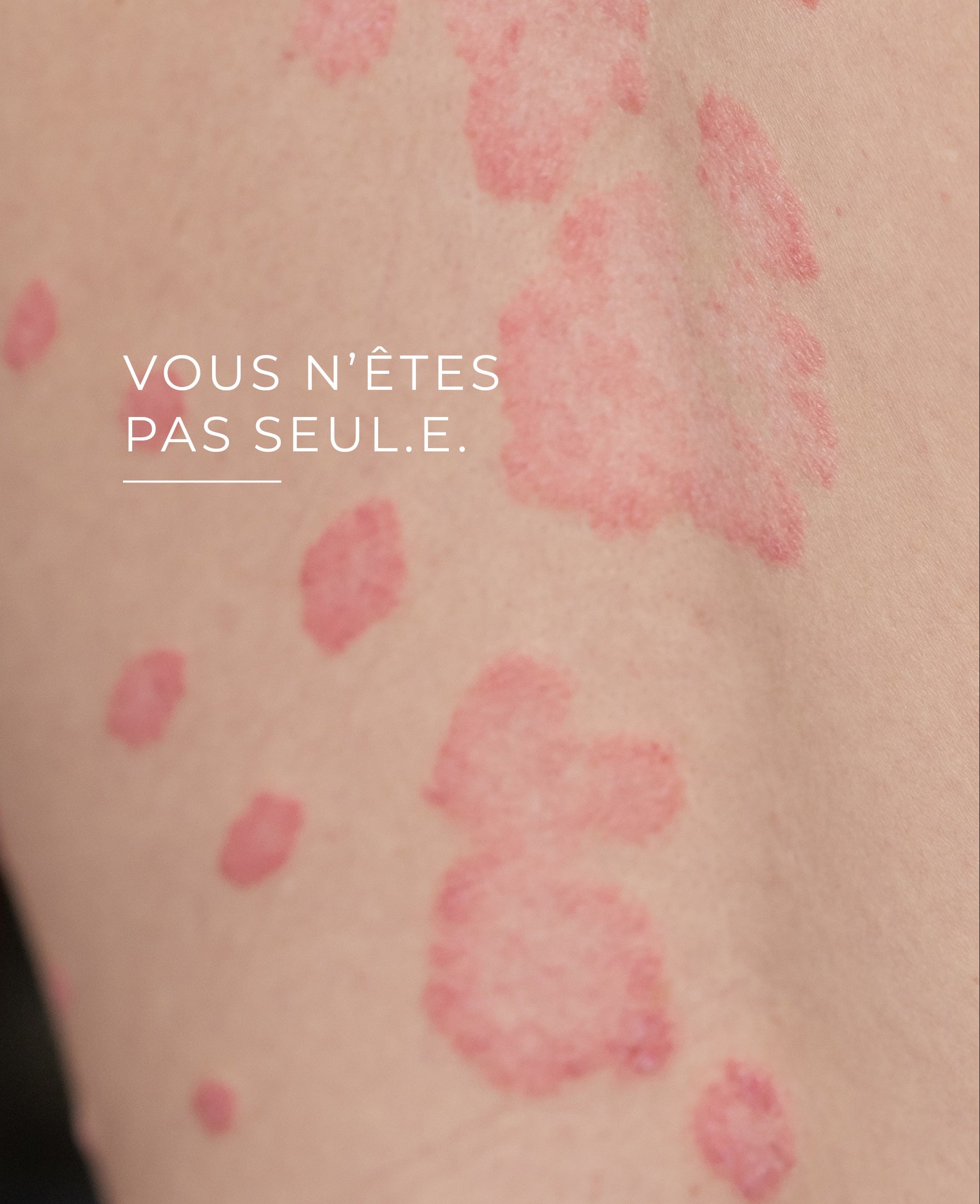 Baume 600ips | Protection Pozone