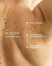 huile ozonée pozone soin peau sensible