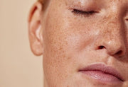 visage tache de rousseur peau sensible pozone huile ozonée